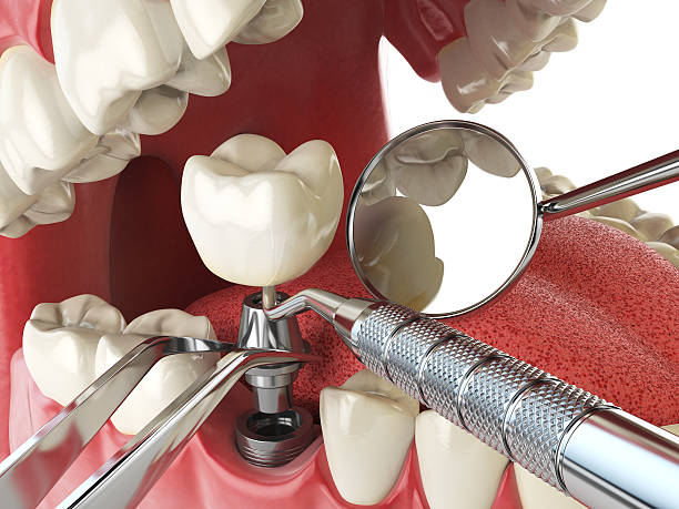 Best Cracked Tooth Emergency Dentist  in Brookside Village, TX